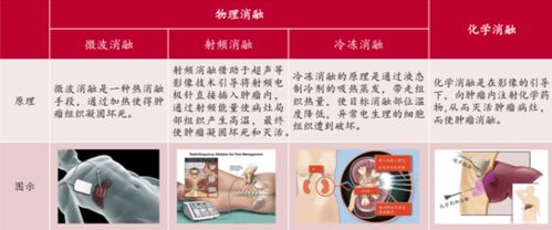 南微醫(yī)學(xué) 688029 微創(chuàng)診療器械龍頭